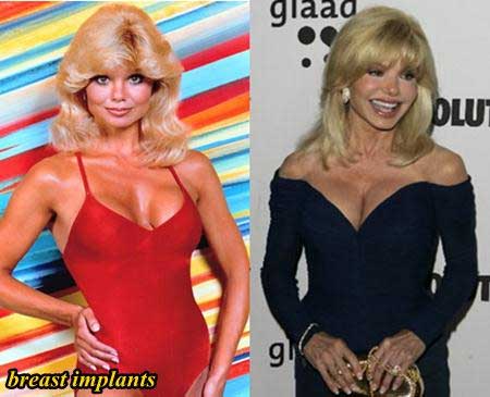 Andersons tits loni Loni Anderson